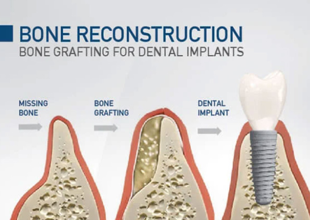 تجديد موجّه