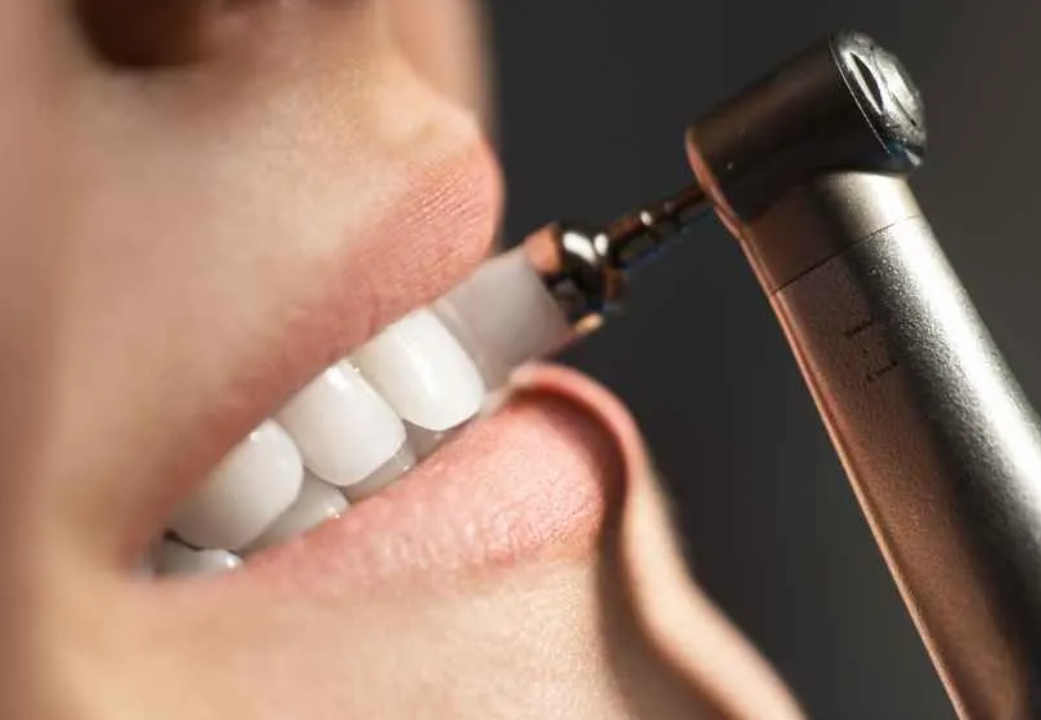 Professional Dental Cleaning Procedure