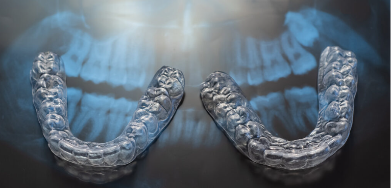 تقويم الأسنان